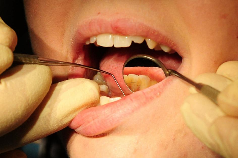 Drop in number of dentists working in the NHS, figures show