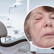 Traumatised pensioner left in 'excruciating' pain as dentists close for bank holiday